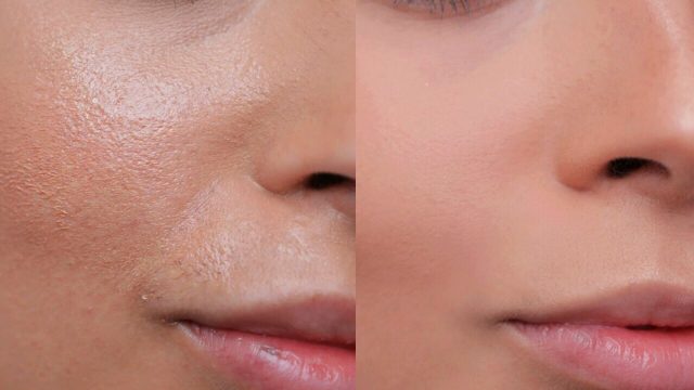 face cream for oily skin Singapore